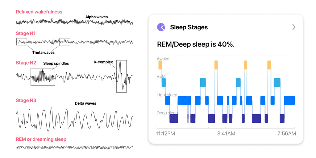 Flowtime Brain Tag: Innovative Sleep Tracker & Brain Trainer